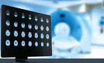 Scottish Medical Imaging Archive
