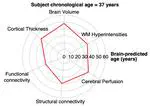 Multimodal Brain Age